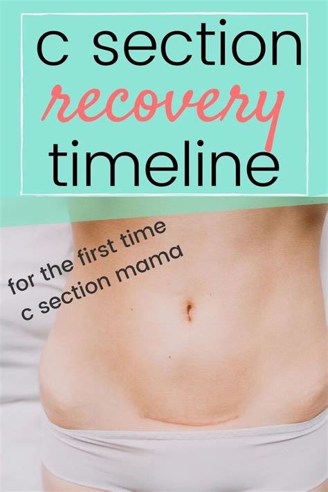 C Section Recovery Timeline A Week By Week Look At Recovery