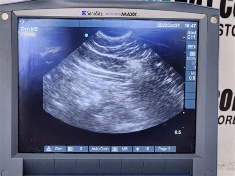 Sonosite Micromaxx Veterinary Ultrasound Machine W C E Probe No