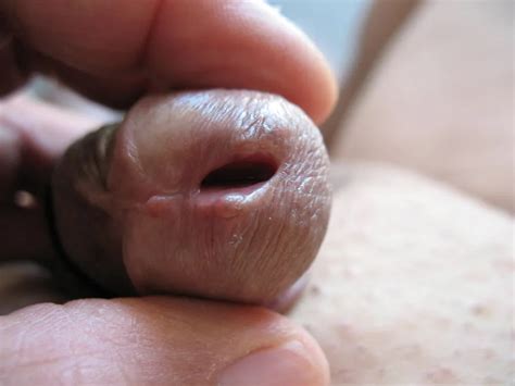 Open Peehole Nude Pics XHamster