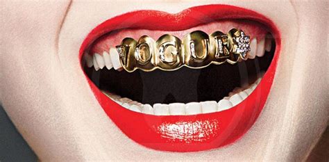 Что такое грилзы и как правильно их носить? – полезные статьи и советы ...