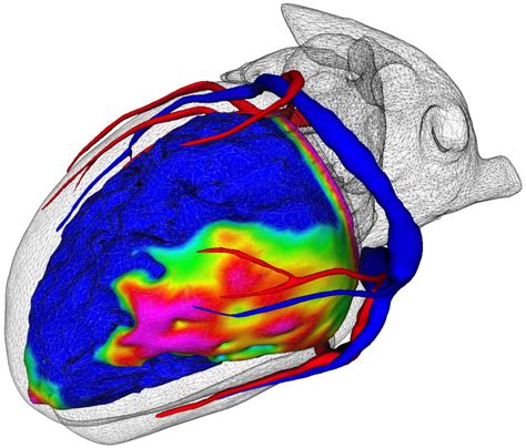 Intelligence Artificielle Imagerie M Dicale Ihu Liryc