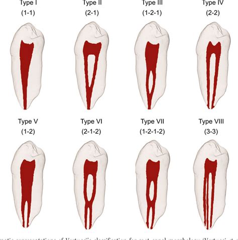 Figure 2 From A New System For Classifying Root And Root Canal Morphology Semantic Scholar