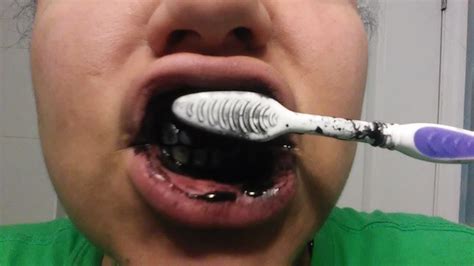 Does Activated Charcoal Whiten Teeth I Brushed With It For A Week