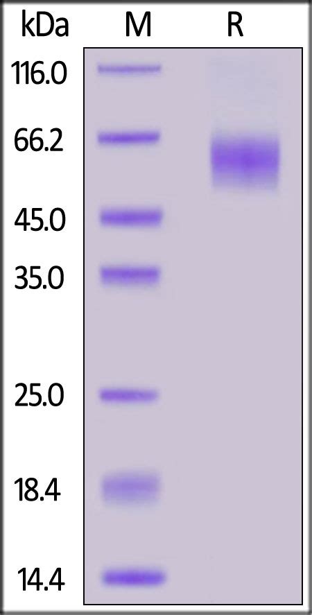 IL 1 Rrp2 IL 1 R6 Recombinant Protein Cat No 11 170 ProSci