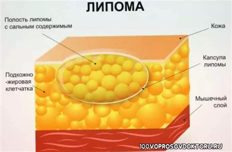 Рассасывающие мази от уплотнений под кожей после уколов, удара ...