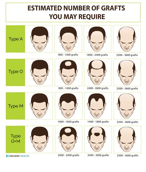 Hair transplant cost: International price comparison guide for hair ...