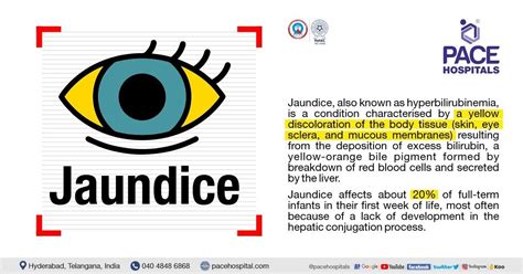 Jaundice Disease - Symptoms, Causes, Complications and Prevention