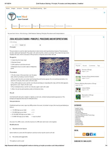 Ziehl Neelsen Staining -Principle, Procedure and Interpretations ...