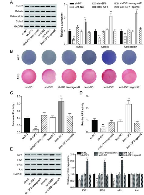 Down Regulation Of Long Non Coding RNA MEG3 Suppresses Osteogenic