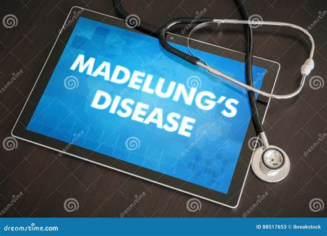 Madelung S Disease (cutaneous Disease) Diagnosis Medical Concept Stock Illustration ...