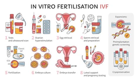 Infográfico De Vetor De Fertilização In Vitro E Esquema De Tratamento