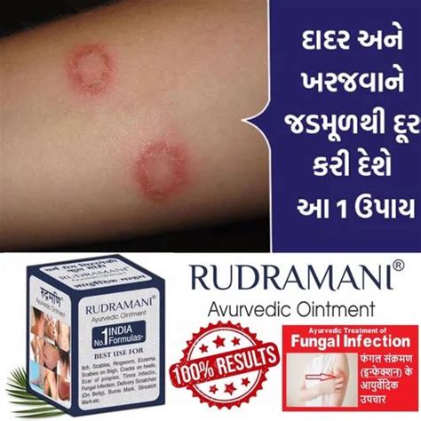 Rudramani Ayurvedic Malam 25gm At Rs 100 Piece Ringworm Ointment In