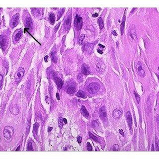 Photomicrograph (H & E stain 20x). | Download Scientific Diagram