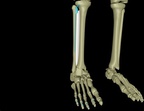 Extensor digitorum longus – Myoreflex