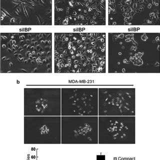 Loss Of IBP Leads To An Inactivation Of EGFR In Breast Carcinoma Cells