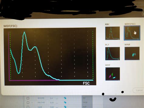 How To Interpret Sysmex Wdffsc Rmedlabprofessionals