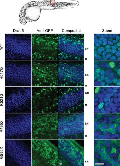 Expression Of Gfp Fus Variants In Spinal Cord Of Zebrafish Embryos