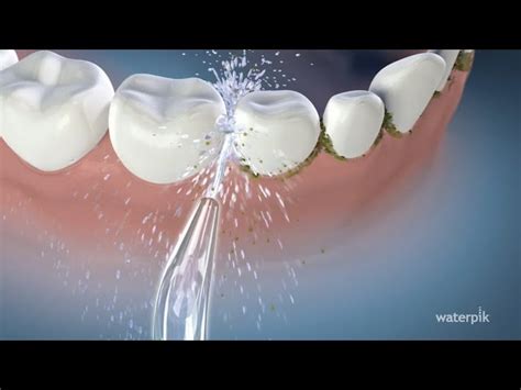 Guía Práctica Aprende Cómo Usar un Irrigador Dental Waterpik para una