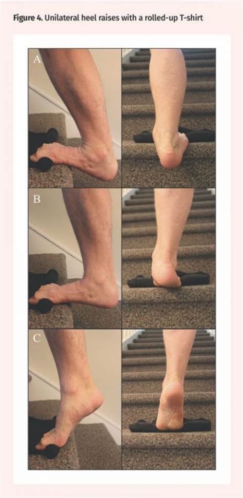 What Is Plantar Fasciopathy