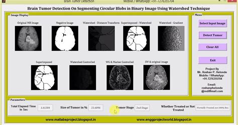 Brain Tumor Detection Using Watershed Technique Matlab Project With