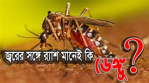 জ্বরের সঙ্গে র‍্যাশ মানেই কি ডেঙ্গু Dengue Fever ডেঙ্গু রোগের