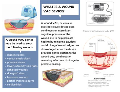 Wound Vac