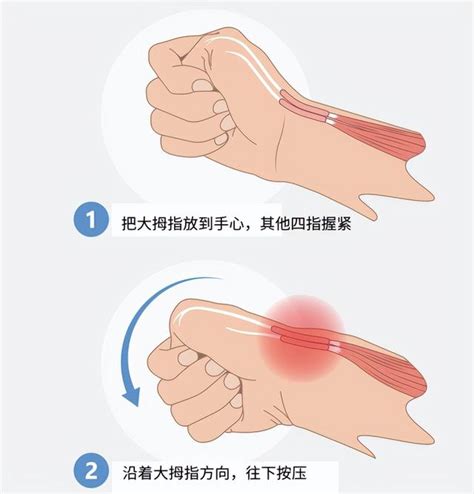 玩手机玩到手腕疼痛？当心腱鞘炎找上门 每日头条