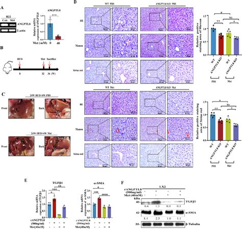 Effect Of Metformin On Hfd Induced Liver Fibrosis A Analysis Of The