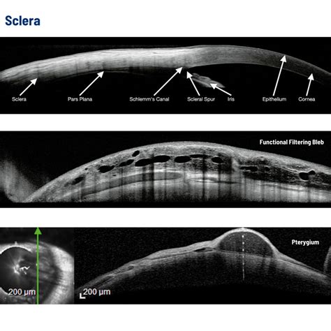 Heidelberg Spectralis Anterior Segment Module Innova