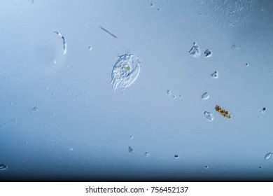 Ciliates Under Microscope Stock Photo 756454927 | Shutterstock