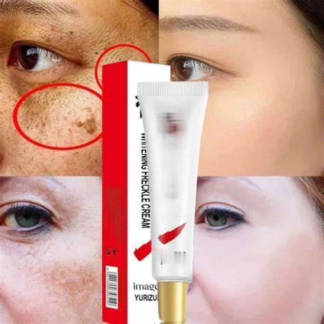 Hitam Ointment Cream Whitening Freckle Cream Remove Dark Spots Removing