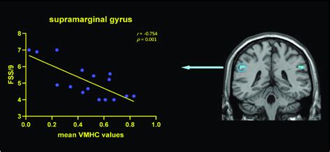 Correlations Between Vmhc Values In Smg And Fss Scores Within The Pdf