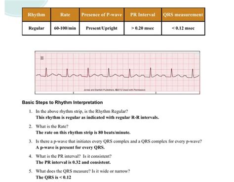 COMPLEX EKG EXAM 1 Flashcards Quizlet