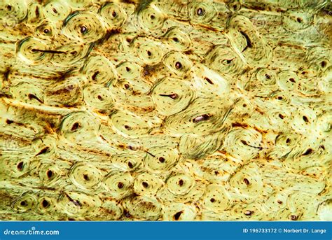 Decalcified Bone Histology