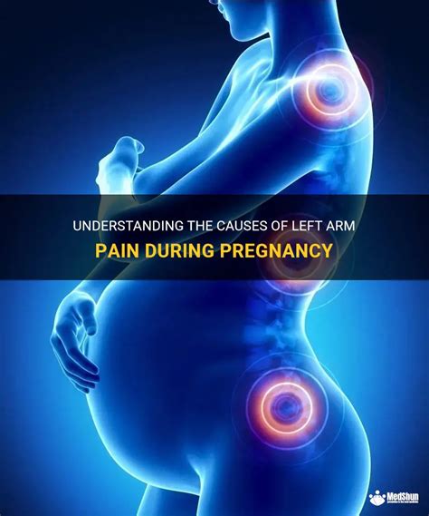 Understanding The Causes Of Left Arm Pain During Pregnancy Medshun