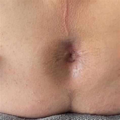 My Sweet Smooth Ass Butthole And Sexy Soles Pics Xhamster