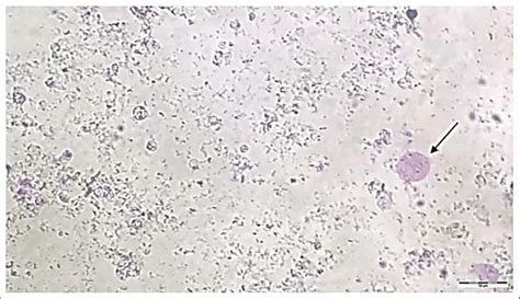 Granular Form Of Blastocystis Sp In Turkey Arrow Download Scientific Diagram