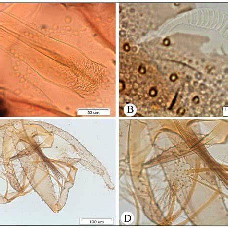 The relative abundance of all sand fly species. | Download Scientific ...