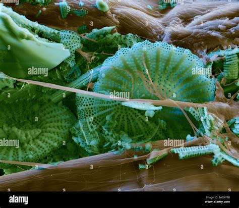 Nanocellulose Mat Color An Lisis Micrograf A De Electrones Sem De