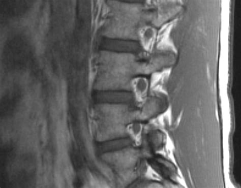 Norma Parasagittal MRI