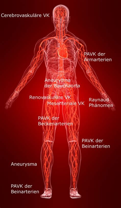 Venenzentrum Z Rich Oerlikon Krankheitsbilder Erkrankungen Arterie