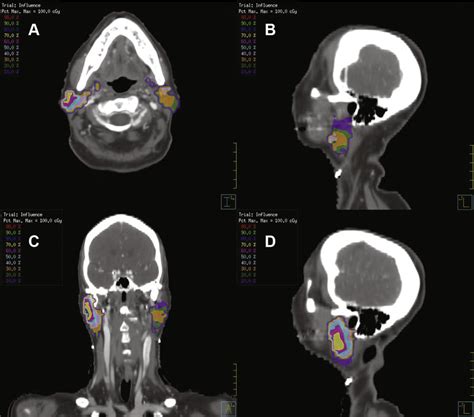 Two Dimensional Cross Sectional Images From Computed Tomography Scans Download Scientific