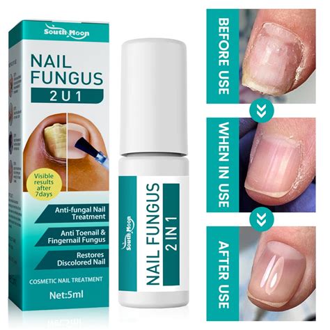 Nail Fungus Treatment Best Nail Repair Stop Fungal Growth Effective