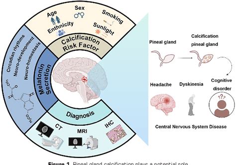 Figure From Exploring Links Between Pineal Gland Calcification And