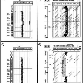 Family 1, array-CGH results. a) Array-CGH graphical overview of ...