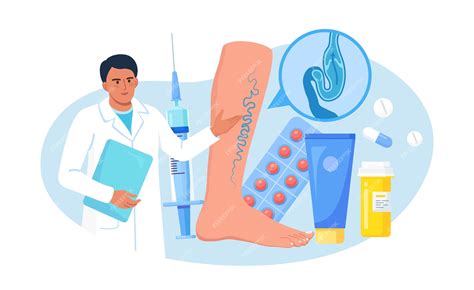 Концепция лечения тромбоза вен и варикозного расширения вен. врач ...