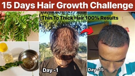 15 Days Hair Growth Hairfall Stop Challenge 100 Results Hairfall