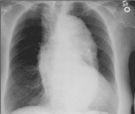 Doctors Network Chest Radiograph Of Different Conditions