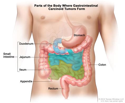 Therapy Benefits Patients With Neuroendocrine Tumors National Cancer