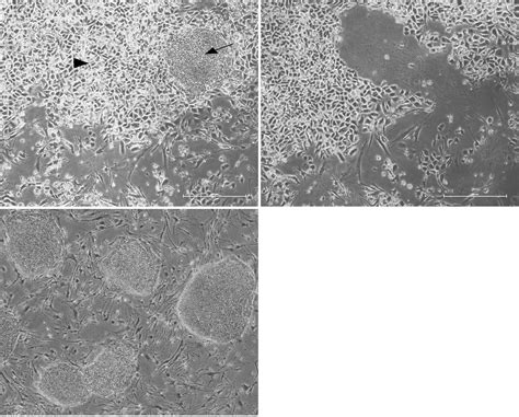 Efficient Generation Human Induced Pluripotent Stem Cells From Human